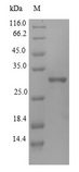 IGFBP1 Protein - (Tris-Glycine gel) Discontinuous SDS-PAGE (reduced) with 5% enrichment gel and 15% separation gel.