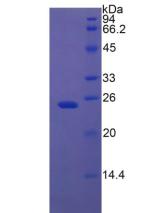 IGFBP7 / TAF Protein - Recombinant Insulin Like Growth Factor Binding Protein 7 By SDS-PAGE