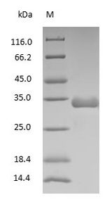 Rat IgG Fc Protein - (Tris-Glycine gel) Discontinuous SDS-PAGE (reduced) with 5% enrichment gel and 15% separation gel.