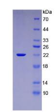 IL-1B / IL-1 Beta Protein - Recombinant Interleukin 1 Beta By SDS-PAGE