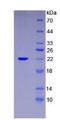 IL-1B / IL-1 Beta Protein - Recombinant Interleukin 1 Beta By SDS-PAGE