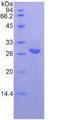 IL-22BP / IL22RA2 Protein - Recombinant Interleukin 22 Receptor Alpha 2 By SDS-PAGE