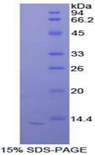IL-33 Protein - Recombinant Interleukin 33 By SDS-PAGE