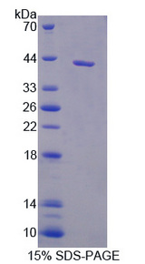 IL11RA Protein - Recombinant Interleukin 11 Receptor Alpha By SDS-PAGE