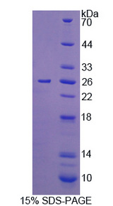 IL12A / p35 Protein - Recombinant Interleukin 12A By SDS-PAGE
