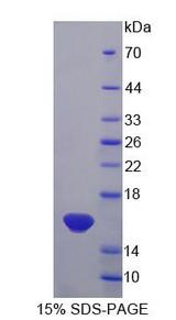 IL13 Protein - Recombinant  Interleukin 13 By SDS-PAGE