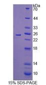 IL17C Protein - Recombinant Interleukin 17C (IL17C) by SDS-PAGE