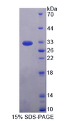 IL17RD Protein - Recombinant  Interleukin 17 Receptor D By SDS-PAGE