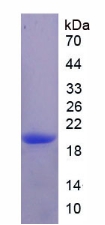 IL17RE Protein - Recombinant Interleukin 17 Receptor E By SDS-PAGE