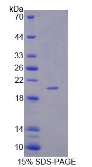 IL1F9 Protein - Recombinant Interleukin 1 Family, Member 9 By SDS-PAGE