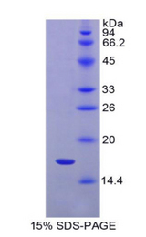 IL1R1 Protein - Recombinant Interleukin 1 Receptor Type I By SDS-PAGE