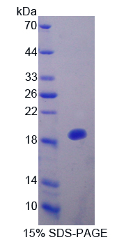IL25 / IL17E Protein - Recombinant  Interleukin 25 By SDS-PAGE