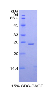 IL27 Protein - Recombinant Interleukin 27 By SDS-PAGE