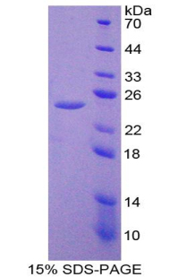 IL27RA Protein - Recombinant Interleukin 27 Receptor Alpha By SDS-PAGE