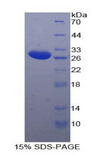 IL2RB / CD122 Protein - Recombinant Interleukin 2 Receptor Beta By SDS-PAGE