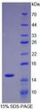 IL34 Protein - Recombinant Interleukin 34 By SDS-PAGE