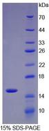 IL34 Protein - Recombinant Interleukin 34 By SDS-PAGE