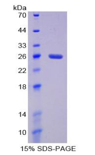 IL4R / CD124 Protein - Recombinant Interleukin 4 Receptor By SDS-PAGE