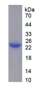 IL6 / Interleukin 6 Protein - Recombinant Interleukin 6 By SDS-PAGE