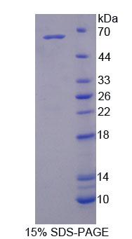 IL6ST / CD130 / gp130 Protein - Recombinant Glycoprotein 130 (gp130) by SDS-PAGE