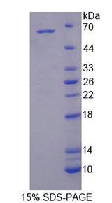 IL6ST / CD130 / gp130 Protein - Recombinant Glycoprotein 130 (gp130) by SDS-PAGE