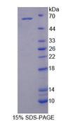 IL6ST / CD130 / gp130 Protein - Recombinant Glycoprotein 130 (gp130) by SDS-PAGE