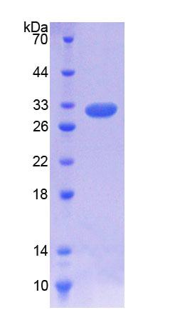 IL7R / CD127 Protein - Recombinant  Interleukin 7 Receptor By SDS-PAGE
