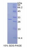 IRAK2 / IRAK-2 Protein - Recombinant Interleukin 1 Receptor Associated Kinase 2 By SDS-PAGE
