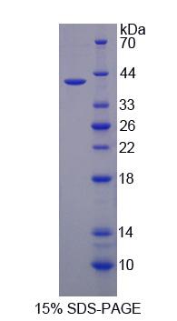 IREB2 / IRP2 Protein - Recombinant  Iron Responsive Element Binding Protein 2 By SDS-PAGE