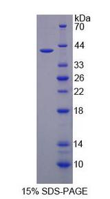 IREB2 / IRP2 Protein - Recombinant  Iron Responsive Element Binding Protein 2 By SDS-PAGE
