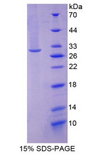 ITGA1/CD49a/Integrin Alpha 1 Protein - Recombinant Integrin Alpha 1 By SDS-PAGE