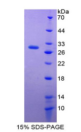 ITGAD / CD11d Protein - Recombinant Integrin Alpha D By SDS-PAGE