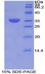 ITGB2 / CD18 Protein - Recombinant Integrin Beta 2 By SDS-PAGE