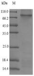 ITGB4 / Integrin Beta 4 Protein - (Tris-Glycine gel) Discontinuous SDS-PAGE (reduced) with 5% enrichment gel and 15% separation gel.