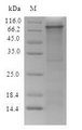 ITGB4 / Integrin Beta 4 Protein - (Tris-Glycine gel) Discontinuous SDS-PAGE (reduced) with 5% enrichment gel and 15% separation gel.