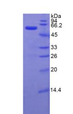 ITIH4 Protein - Recombinant Inter Alpha-Globulin Inhibitor H4 By SDS-PAGE