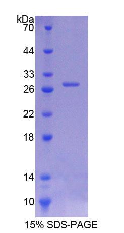 ITSN1 / ITSN Protein - Recombinant  Intersectin 1 By SDS-PAGE