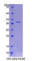 ITSN1 / ITSN Protein - Recombinant  Intersectin 1 By SDS-PAGE