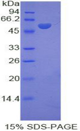 Kinesin 5A / KIF5A Protein - Recombinant Kinesin Family, Member 5A By SDS-PAGE