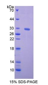 Kinesin Heavy Chain / KIF5B Protein - Recombinant  Kinesin Family, Member 5B By SDS-PAGE