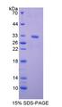Kinesin Heavy Chain / KIF5B Protein - Recombinant  Kinesin Family, Member 5B By SDS-PAGE