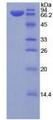 KL / Klotho Protein - Recombinant Klotho By SDS-PAGE
