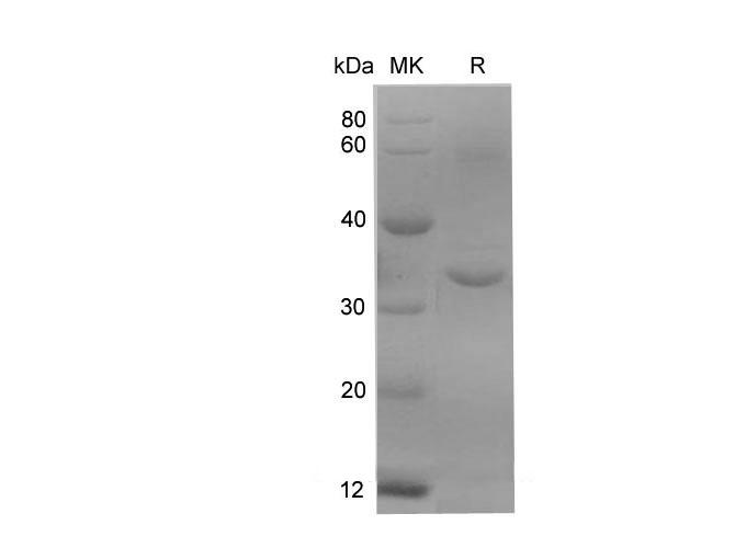 KLK10 / Kallikrein 10 Protein - Recombinant Rat KLK10 Protein (His Tag)-Elabscience