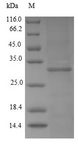 KMO Protein - (Tris-Glycine gel) Discontinuous SDS-PAGE (reduced) with 5% enrichment gel and 15% separation gel.