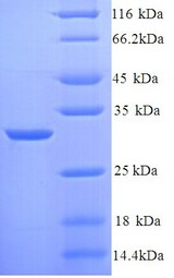 KNG1 / Kininogen / Bradykinin Protein