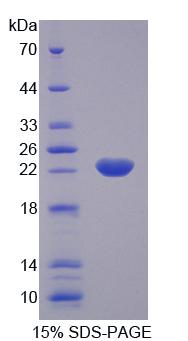 KTN1 / Kinectin Protein - Recombinant Kinectin 1 By SDS-PAGE