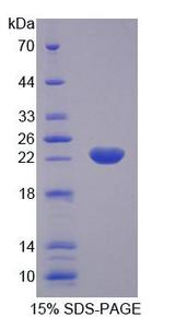 KTN1 / Kinectin Protein - Recombinant Kinectin 1 By SDS-PAGE