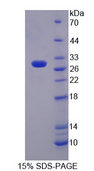 LAG3 Protein - Recombinant Lymphocyte Activation Gene 3 By SDS-PAGE