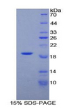 LALBA / Alpha Lactalbumin Protein - Recombinant Alpha-Lactalbumin By SDS-PAGE