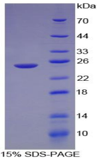 LAMA1 / Laminin Alpha 1 Protein - Recombinant Laminin Alpha 1 By SDS-PAGE